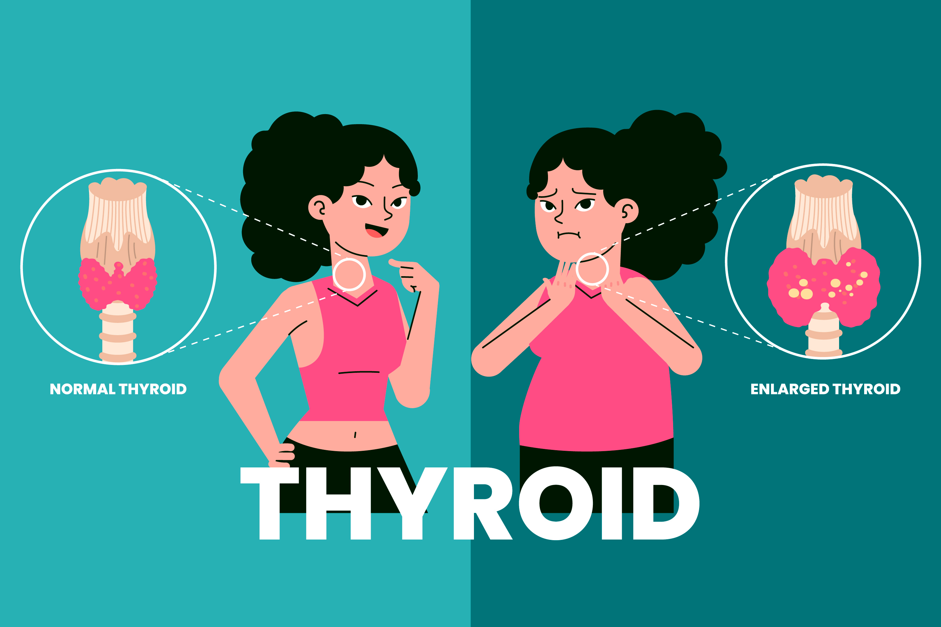 Thyroid Care Guide